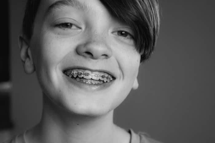 Sonhar com aparelho dentário pode ser negativo?